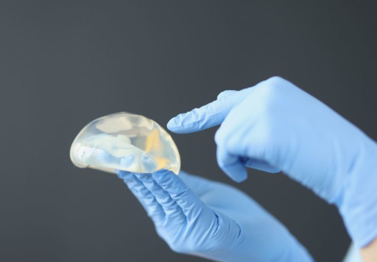 Explantacion protesis mamarias